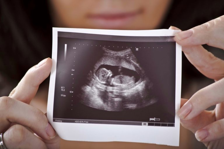 Родить после 40. Современная репродуктология в КДФ побеждает возраст