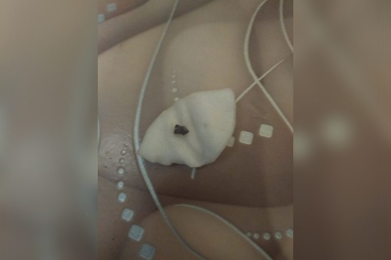 Дети-живодеры в Тверской области обстреляли из пневматики кота