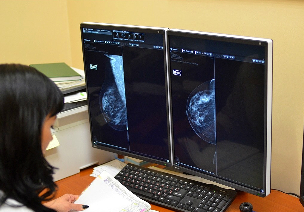 Елена Кочерова: «Рак молочной железы, выявленный на ранних стадиях, излечим в 95 – 98% случаев»