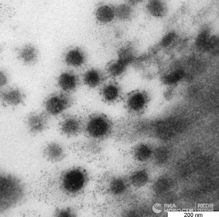 Опубликованы фото дельта-штамма коронавируса