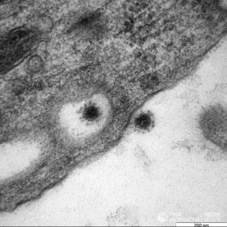 Опубликованы фото дельта-штамма коронавируса