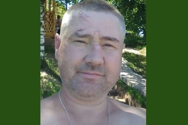 В Тверской области прекращены поиски пропавшего мужчины со шрамом