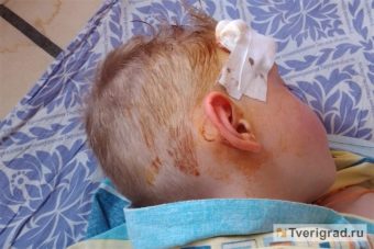Шестилетнего мальчика избили на стадионе в Твери