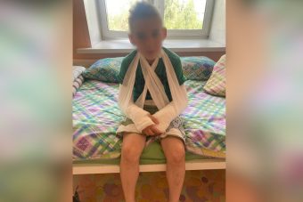 Под Тверью в пришкольном лагере ребёнок сломал обе руки