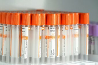 Жители Тверской области проверяют свое репродуктивное здоровье