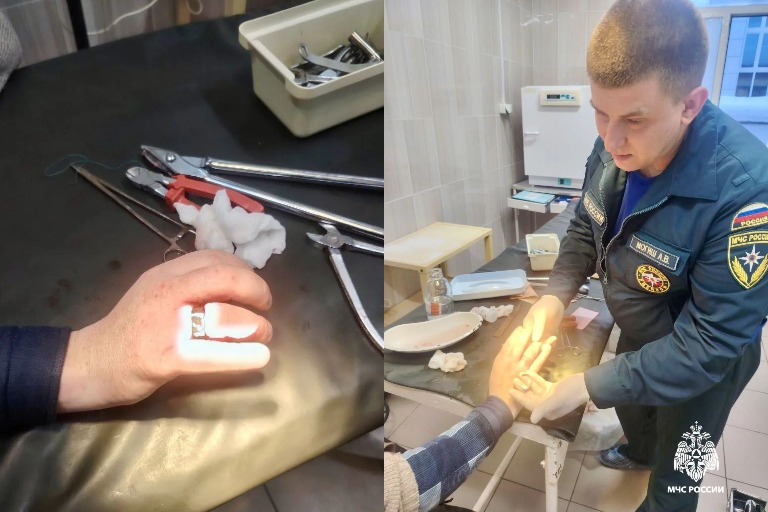 Спасатели «раскольцевали» мужчину в Тверской области