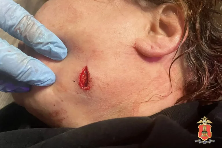 В Тверской области мужчина набросился с ножом на тёщу