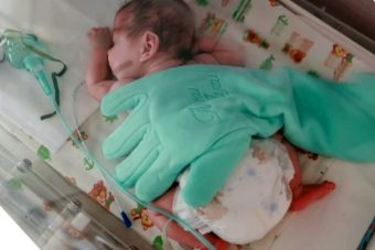 В Тверской области врачи спасли ребёнка с экстремально низкой массой тела