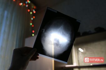 В Тверской области больницу уличили в незаконном бездействии